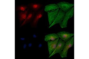 Phospho-IRF5 (Ser446) Antibody staining A549 cells(heat shock treatment) by IF/ICC. (IRF5 anticorps  (pSer446))