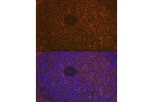 Immunofluorescence analysis of rat spleen using CD35/CR1 Rabbit mAb (ABIN7266477) at dilution of 1:100 (40x lens). (CD35 anticorps)