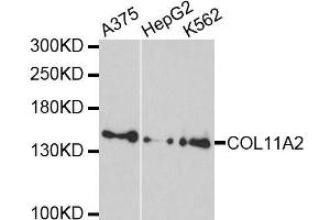 Western blot analysis of extracts of various cell lines, using COL11A2 antibody.