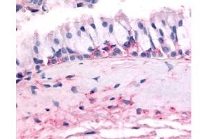 Immunohistochemical staining of Nasal Mucosa (Respiratory Epithelium) using anti- OR10J5 antibody ABIN122515