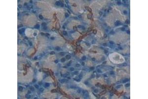 IHC-P analysis of Kidney tissue, with DAB staining. (IL20RA anticorps  (AA 273-543))
