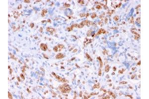 Formalin-fixed, paraffin-embedded human Placenta stained with Spectrin alpha 1 Mouse Recombinant Monoclonal Antibody (rSPTA1/1832). (Recombinant SPTA1 anticorps  (AA 356-475))
