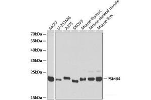 Western blot analysis of extracts of various cell lines using PSMB4 Polyclonal Antibody at dilution of 1:1000. (PSMB4 anticorps)