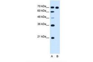 Image no. 1 for anti-Ribonucleotide Reductase M1 (RRM1) (AA 723-772) antibody (ABIN321011) (RRM1 anticorps  (AA 723-772))