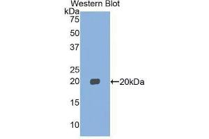 Western Blotting (WB) image for anti-Myosin, Light Chain 2, Regulatory, Cardiac, Slow (MYL2) (AA 2-159) antibody (ABIN1859939) (MYL2 anticorps  (AA 2-159))