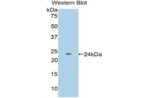 Western Blotting (WB) image for anti-Pregnancy Zone Protein (PZP) (AA 1212-1391) antibody (ABIN1176525) (PZP anticorps  (AA 1212-1391))