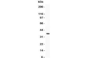 Western blot testing of FOXO3A antibody and recombinant human protein (0. (FOXO3 anticorps  (AA 471-673))