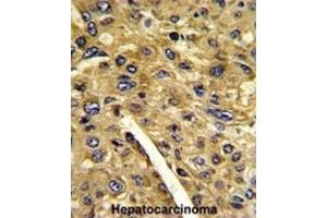 Immunohistochemistry (IHC) image for anti-Aminomethyltransferase (AMT) antibody (ABIN3002783)