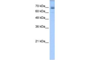 Western Blotting (WB) image for anti-Ligand of Numb-Protein X 1 (LNX1) antibody (ABIN2462688) (LNX1 anticorps)