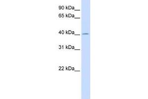 Human Liver; WB Suggested Anti-ACAA2 Antibody Titration: 0. (ACAA2 anticorps  (N-Term))