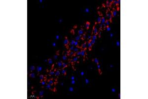 Immunofluorescent analysis of paraffin embedded rat hippocampus using RPL10L (ABIN7075429) at dilution of 1: 400
