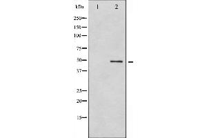 Western blot analysis of GFAP phosphorylation expression in HeLa whole cell lysates,The lane on the left is treated with the antigen-specific peptide. (GFAP anticorps  (pSer38))