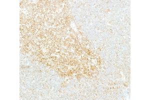Immunohistochemistry (IHC) image for anti-Nuclear Factor-kB p65 (NFkBP65) (C-Term) antibody (ABIN7795799) (Recombinant NF-kB p65 anticorps  (C-Term))
