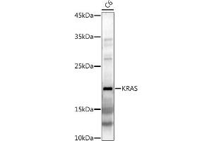 Western blot analysis of extracts of C6 cells, using KRAS antibody (ABIN3021676, ABIN3021677, ABIN3021678, ABIN1513137 and ABIN1514282) at 1:1000 dilution. (K-RAS anticorps)