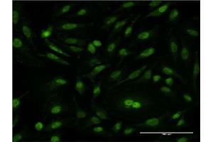Immunofluorescence of monoclonal antibody to CSE1L on HeLa cell. (Exportin 2 anticorps  (AA 872-971))