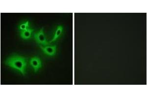 Immunofluorescence analysis of A549 cells, using CDH4 Antibody. (Cadherin 4 anticorps  (AA 731-780))
