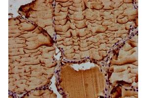 IHC image of ABIN7156513 diluted at 1:100 and staining in paraffin-embedded human thyroid tissue performed on a Leica BondTM system.