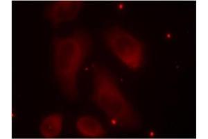 Image no. 3 for anti-LIM Domain Kinase 1 (LIMK1) (pThr508) antibody (ABIN196830) (LIM Domain Kinase 1 anticorps  (pThr508))