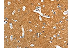 The image on the left is immunohistochemistry of paraffin-embedded Human brain tissue using ABIN7128257(ADD2 Antibody) at dilution 1/15, on the right is treated with fusion protein. (ADD2 anticorps)