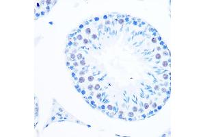 Immunohistochemistry of paraffin-embedded mouse testis using DNA Polymerase beta Rabbit mAb (ABIN7269456) at dilution of 1:100 (40x lens).