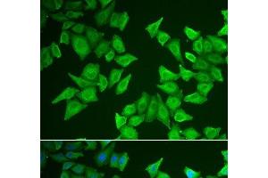 Immunofluorescence analysis of HeLa cells using ALAS2 Polyclonal Antibody (ALAS2 anticorps)