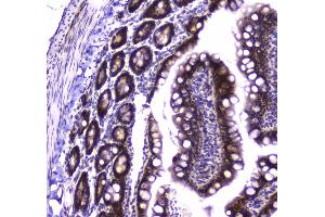 IHC analysis of Glutathione Reductase using anti-Glutathione Reductase antibody .