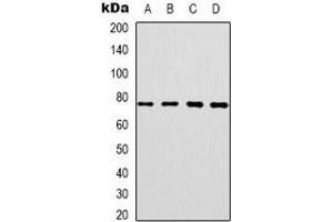 Western blot analysis of CEP76 expression in SKOV3 (A), HT29 (B), HepG2 (C), NIH3T3 (D) whole cell lysates.
