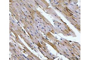 IHC analysis of Aconitase 2 using anti-Aconitase 2 antibody (ABIN7602770). (ACO2 anticorps  (C-Term))