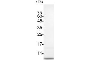Epidermal Growth Factor (EGF) (Active) protein (His tag)