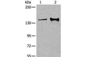 Western blot analysis of Hela and A172 cell lysates using CAPN15 Polyclonal Antibody at dilution of 1:400 (Calpain 15/SOLH anticorps)