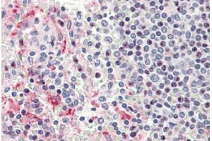 Human Spleen (formalin-fixed, paraffin-embedded) stained with HPSE antibody ABIN337167 at 5 ug/ml followed by biotinylated goat anti-rabbit IgG secondary antibody ABIN481713, alkaline phosphatase-streptavidin and chromogen. (HPSE anticorps)
