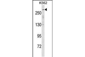 Western blot analysis in K562 cell line lysates (35ug/lane). (SCN5A anticorps  (N-Term))