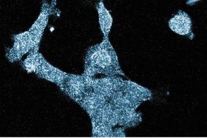Immunofluorescence staining of A431cells (Human epithelial carcinoma, ATCC CRL-1555) with the mouse anti-GIT1 antibody. (GIT1 anticorps  (AA 664-770))