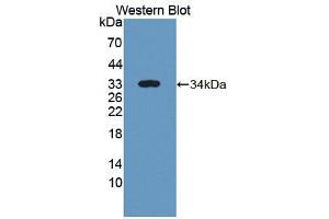 Western blot analysis of the recombinant protein. (ICK anticorps  (AA 1-284))