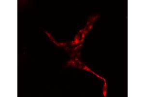 ABIN6274410 staining HepG2 cells by IF/ICC.
