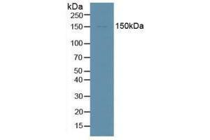 Western blot analysis of Human HepG2 Cells. (DDX58 anticorps  (AA 1-211))