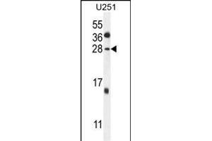 GGTLC2 Antibody (Center) (ABIN654174 and ABIN2844032) western blot analysis in  cell line lysates (35 μg/lane).