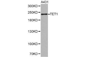 Western blot analysis of extracts of A431 cell lines, using TET1 antibody.