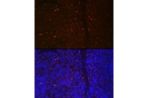 Immunofluorescence analysis of rat spleen cells using RUNX2 Rabbit pAb (ABIN3016833, ABIN3016834, ABIN3016835 and ABIN6219851) at dilution of 1:100 (40x lens).