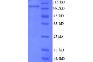 SDS-PAGE (SDS) image for E3 ubiquitin-protein ligase RAD18 (RAD18) (AA 1-495), (full length) protein (His-SUMO Tag) (ABIN5711931)