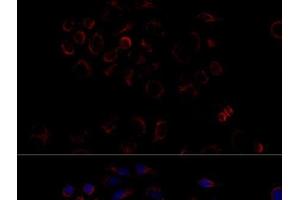 Immunofluorescence analysis of HeLa cells using ATP5B Polyclonal Antibody at dilution of 1:100 (40x lens).