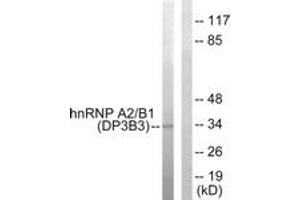 Western Blotting (WB) image for anti-Heterogeneous Nuclear Ribonucleoprotein A2/B1 (HNRNPA2B1) (AA 1-50) antibody (ABIN2889424) (HNRNPA2B1 anticorps  (AA 1-50))