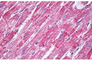 Image no. 2 for anti-Superoxide Dismutase 2, Mitochondrial (SOD2) antibody (ABIN1496289) (SOD2 anticorps)