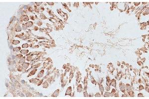 Immunohistochemistry of paraffin-embedded Rat testis using KIF2C Polyclonal Antibody at dilution of 1:100 (40x lens). (KIF2C anticorps)