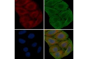 ABIN6259956 and ABIN6276843 staining Hela cells(30 min of UV treatment) by IF/ICC. (Annexin V anticorps  (C-Term))