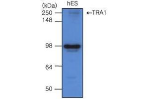 The cell lysates of hES(20 ug) were resolved by SDS-PAGE, transferred to PVDF membrane and probed with anti-human TRA 1 (1:500).