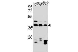 Western blot analysis of HNRNPC Antibody (C-term) in Jurkat,K562,U251 cell line lysates (35ug/lane).