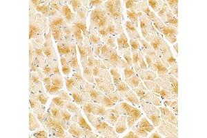 Immunohistochemistry of paraffin embedded mouse heart using Igfn1 (ABIN7074278) at dilution of 1:700 (400x lens)