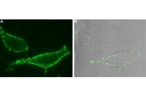 Expression of TRPV6 in human LNCaP cells - Cell surface detection of TRPV6 in intact living human prostate carcinoma (LNCaP) cells.