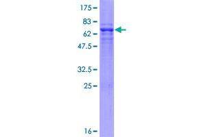 Image no. 1 for WD Repeat, Sterile alpha Motif and U-Box Domain Containing 1 (WDSUB1) (AA 1-384) protein (GST tag) (ABIN1325295)